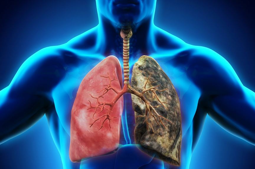 Image result for Respiratory Diseases - Everything about it.